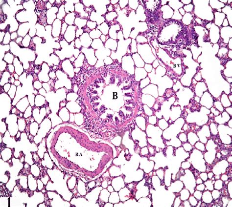 A Photomicrograph Of A Section In The Lung Of A Control Group Group I