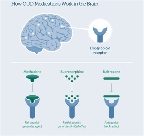 MAT Medication Assisted Treatment Drug Alcohol Addiction Treatment