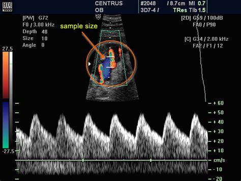 Doppler Ultrasound Principles And Practice