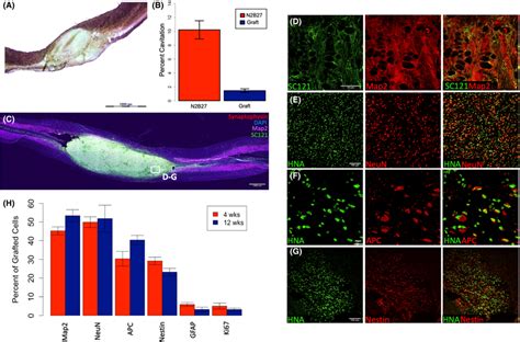 Transplanted Human IPSCDerived SNPCs Fill The Lesion Cavity And