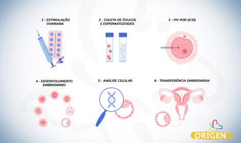 Etapas da FIV conheça melhor o procedimento Clínica Origen