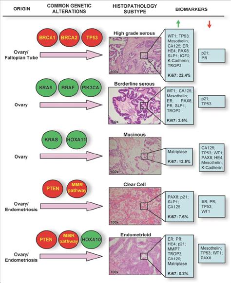 Histological And Molecular Heterogeneity In Epithelial Ovarian Cancers