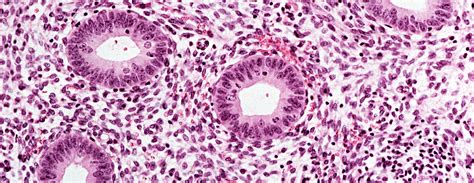 Endometrial biopsy