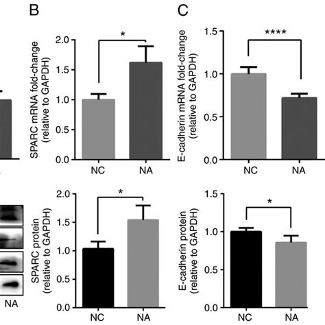 Mir 29a 3p And Sparc Are Involved In Na A Mir 29a 3p B Sparc C Download Scientific