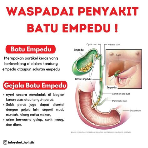 MENGENAL PENYAKIT BATU EMPEDU DAN SOLUSINYA Hanny Bamboo