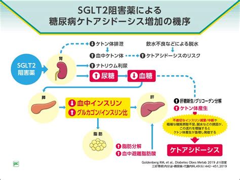 Sglt2阻害薬の適正使用 糖尿病ケトアシドーシス編｜べーリンガープラス