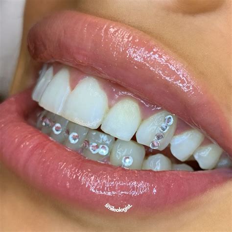 Tooth Gem Inspo Y2k Glam Diamond Tooth Tooth Bling Tooth Jewellery Glam