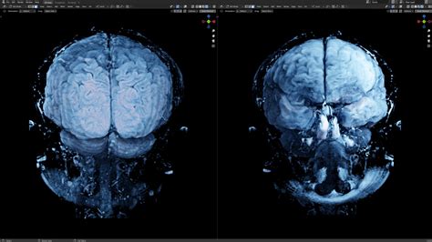 Brain Mri Scan 3d