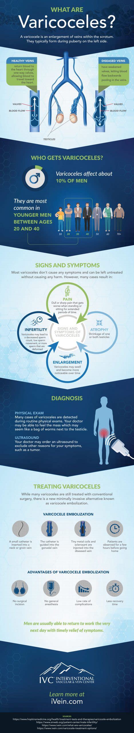 What Are Varicoceles Ivc Interventional Vascular And Vein Center