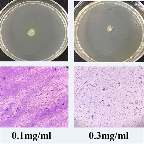 Motility And Biofilm Formation Inhibition In P Aeruginosa A