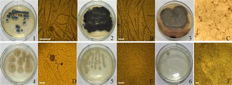 Colony Morphology 16 And Microstructure Diagrams Of The Strains Download Scientific Diagram