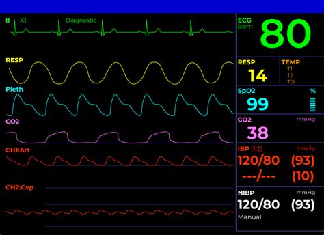 How To Read A Hospital Monitor: Understanding Vital Signs, 53% OFF