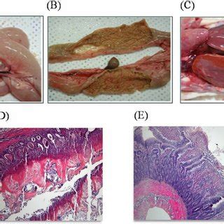 Gross And Histological Findings In Broilers With Necrotic Enteritis