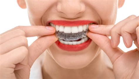 How Important Is It To Wear A Retainer After Braces Htv