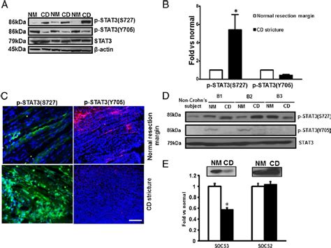 Stat3s727 And Stat3y705 Are Differentially Phosphorylated And Socs3