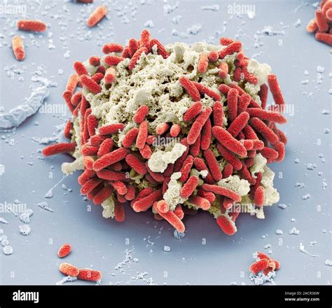 E Coli Bakterien Farbige Scanning Electron Micrograph Sem Von