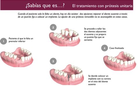 Pr Tesis Clinica Dental Carlos Mungu A