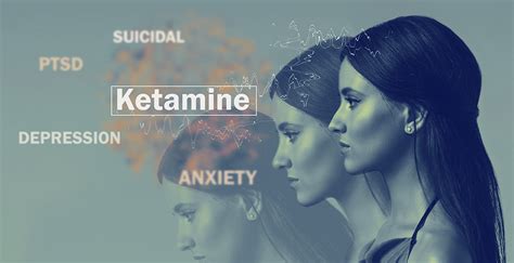 Ketamine Infusion Therapy At Maxwell Clinic Your Top Questions Answered