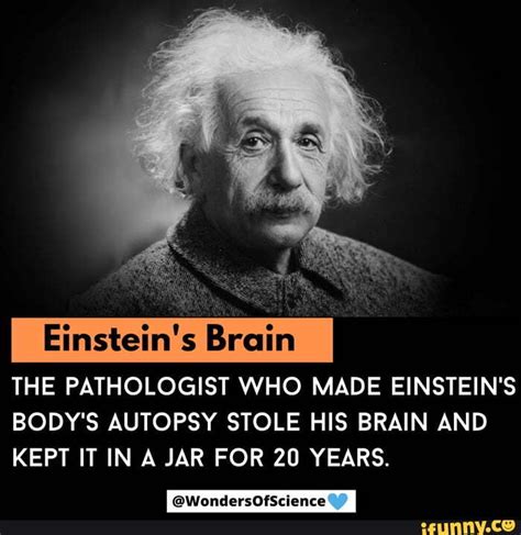 Einstein S Brain The Pathologist Who Made Einstein S Body S Autopsy Stole His Brain And Kept It