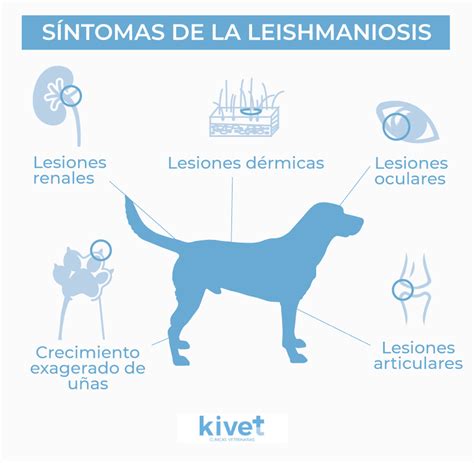 Qu Es La Leishmania Y Qu S Ntomas Tiene Consejos