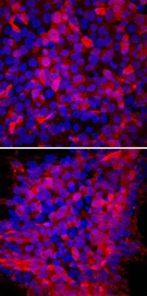TRA-1-60(R) Antibody (TRA-1-60) 0.025mL; Unlabeled:Antibodies ...