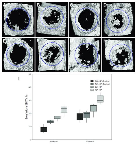 Representative Micro Ct Images Of Calvarial Defects At Weeks A D