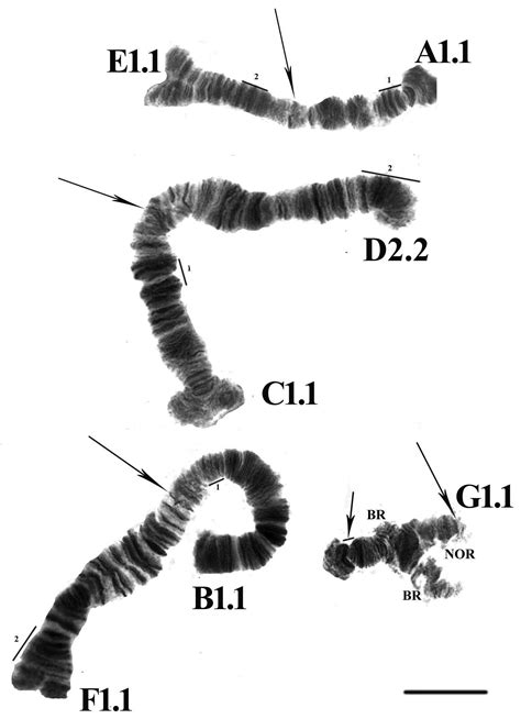 Figure 14 In Markers In The Polytene Chromosomes Of Freshwater