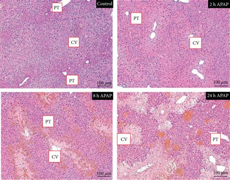 Time Course Of APAP Induced Hepatic Injury In ICR Mice A