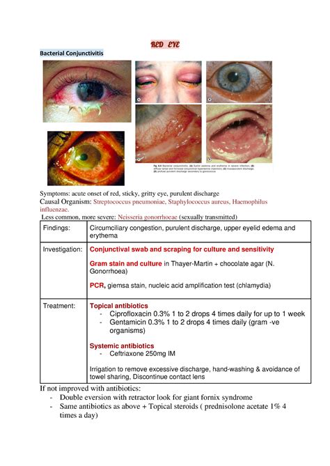 Ophthalmology Notes Conjunctivitis Red Eye Bacterial Conjunctivitis Symptoms Acute Onset Of