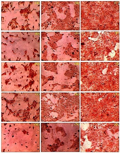 Adherent Morphology Of Stained Images Of Human Keratinocytes Like Hacat