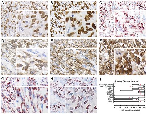 Differential Diagnosis Of Solitary Fibrous Tumors A Study Of 454 Soft