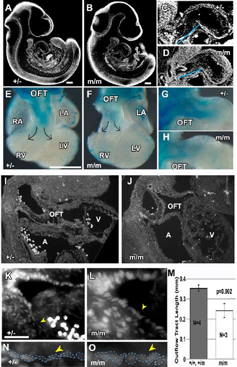 Bj Mutants Have Shortened Outflow Tract And Defects In Neural Crest And