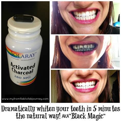 How To Whiten Teeth With Activated Charcoal Tablets Teethwalls