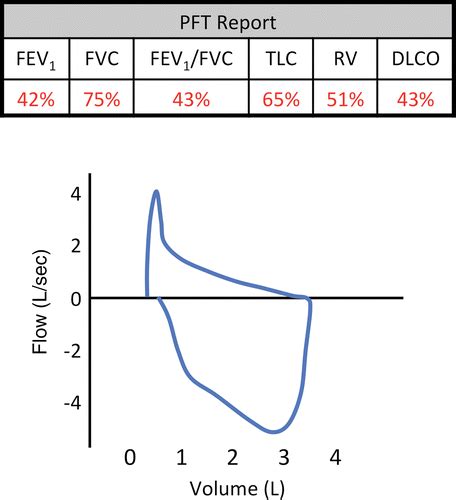 Pulmonary Function Tests For The Radiologist Radiographics