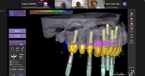 Celebrados Nuevos Cursos Del Ciclo Cad Cam Exocad