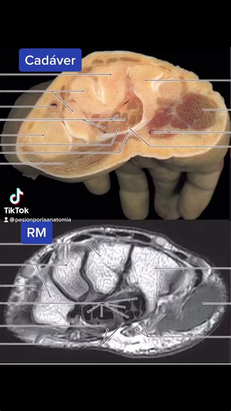 Pasión por la Anatomía on Twitter Repasamos estructuras anatómicas en