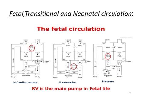 Persistent Pulmonary Hypertension Of Newborn Pphn