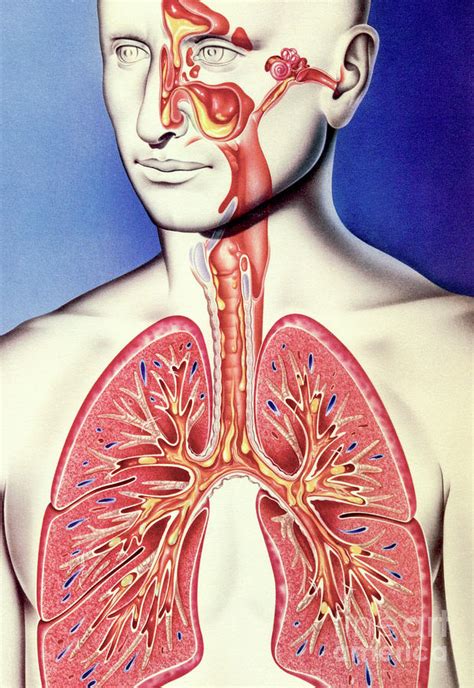 Upper And Lower Respiratory Tract Infections Photograph By John Bavosi Science Photo Library