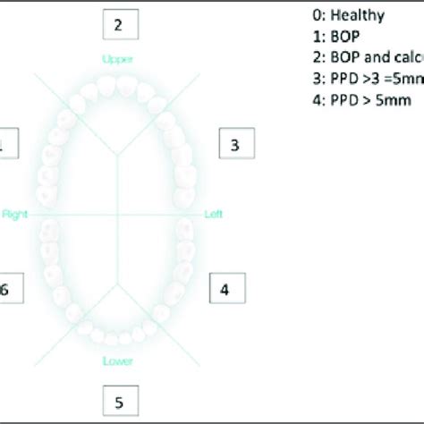 Psr Illustration Of Sextants And Description Of Periodontal Probing