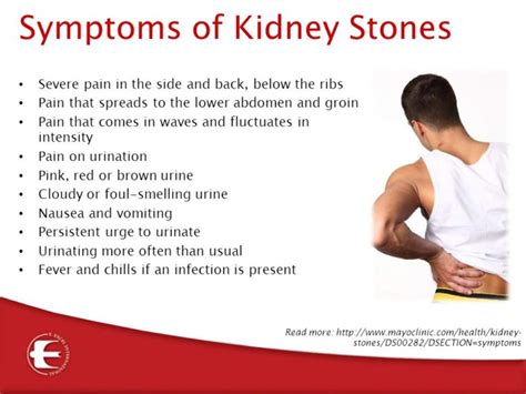 What are the symptoms of kidney stones? - Times Lifestyle