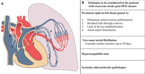 Transcatheter Closure Of Patent Foramen Ovale Circulation