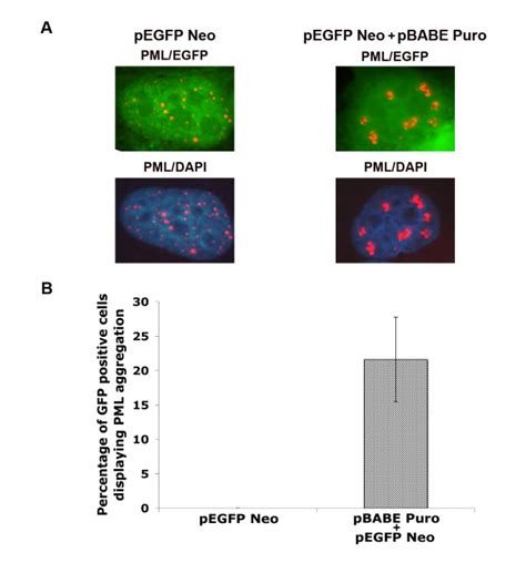 Pml Aggregation Occurs Specifically In Transfected Cells Pegfp Neo