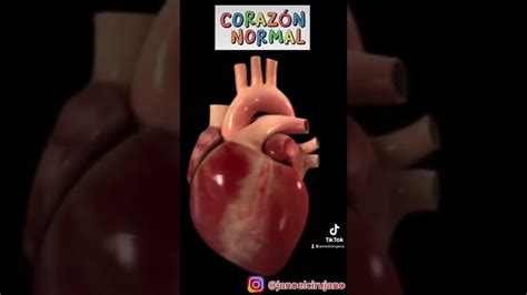 Descubre Cómo Se Escucha Un Corazón Sano Consejos Para Cuidar Tu Salud