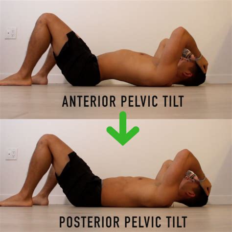 Fix Anterior Pelvic Tilt In 10 Minutes Per Day With This Corrective