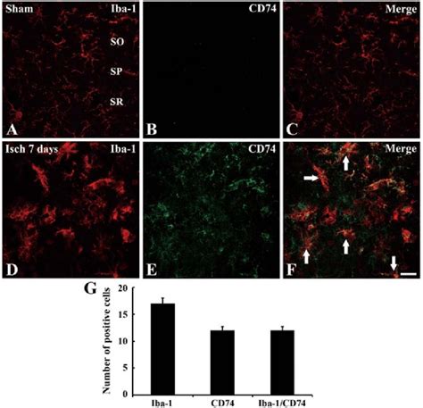 Double Immunofluorescence Staining For Iba And Cd In The