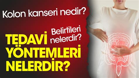 Kolon Kanseri Nedir Kolon Kanseri Belirtileri Nelerdir Kolon Kanseri