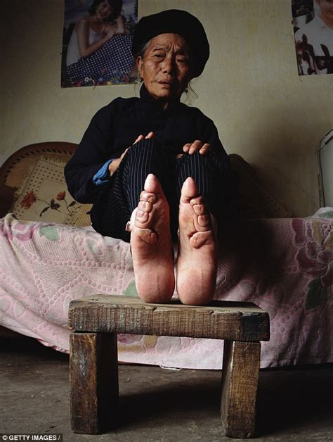 Chinese Woman Recalls Having Her Feet Broken Because Women With Big