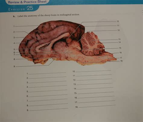 34 Label The Sheep Brain Labels Design Ideas 2020