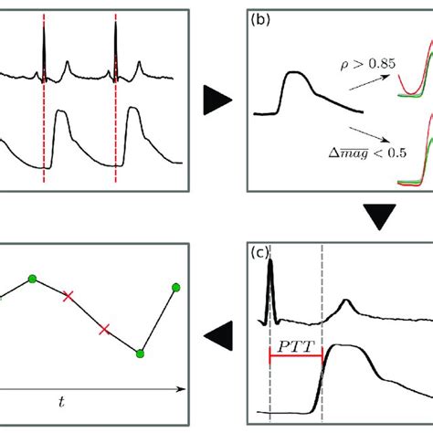 Flowchart Of The Pw Detection Pre Processing A The R Peak In The Ecg