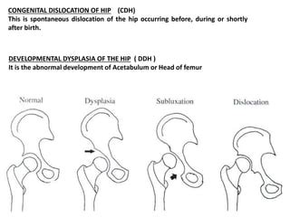 CDH AND DDH PPT